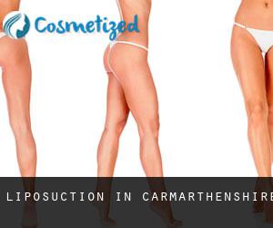 Liposuction in Carmarthenshire
