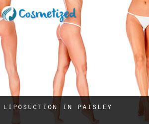 Liposuction in Paisley