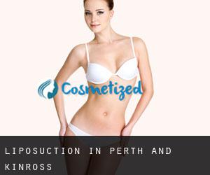 Liposuction in Perth and Kinross