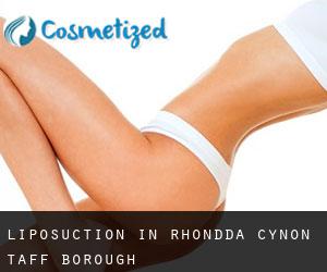 Liposuction in Rhondda Cynon Taff (Borough)