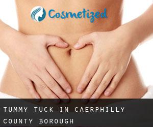 Tummy Tuck in Caerphilly (County Borough)