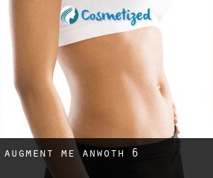 Augment Me (Anwoth) #6