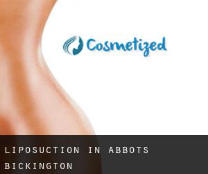Liposuction in Abbots Bickington