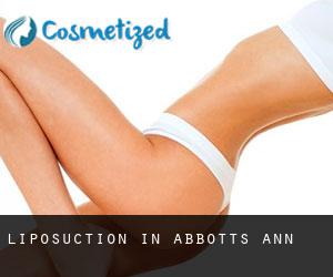 Liposuction in Abbotts Ann