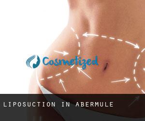 Liposuction in Abermule