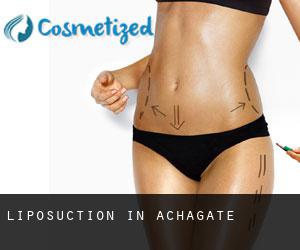 Liposuction in Achagate