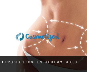 Liposuction in Acklam Wold