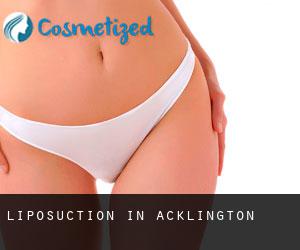 Liposuction in Acklington