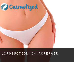 Liposuction in Acrefair