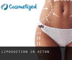 Liposuction in Acton
