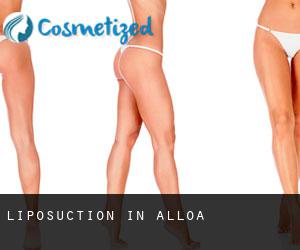 Liposuction in Alloa