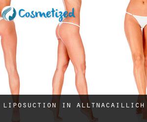 Liposuction in Alltnacaillich