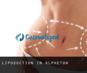 Liposuction in Alpheton