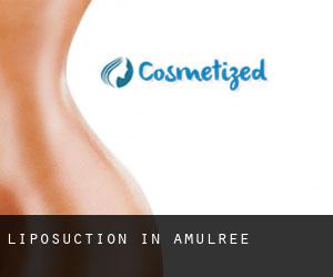 Liposuction in Amulree