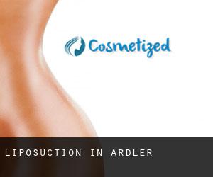 Liposuction in Ardler