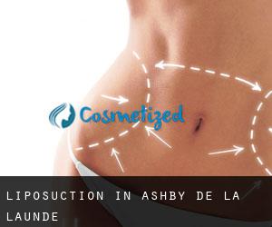Liposuction in Ashby de la Launde