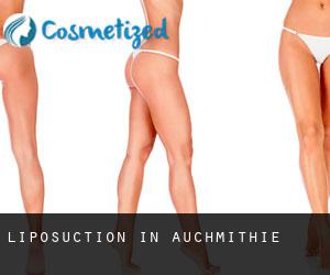 Liposuction in Auchmithie