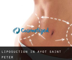 Liposuction in Ayot Saint Peter