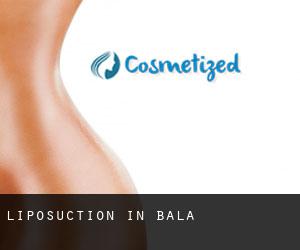 Liposuction in Bala