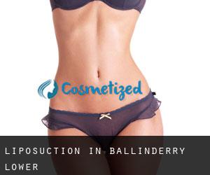Liposuction in Ballinderry Lower