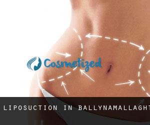 Liposuction in Ballynamallaght