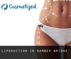 Liposuction in Bamber Bridge
