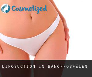 Liposuction in Bancffosfelen