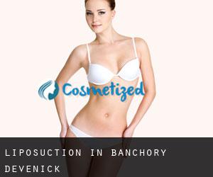 Liposuction in Banchory Devenick