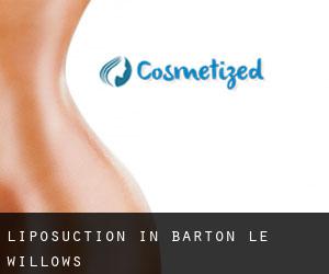 Liposuction in Barton le Willows