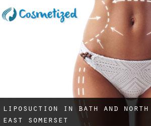 Liposuction in Bath and North East Somerset