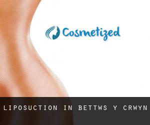 Liposuction in Bettws y Crwyn