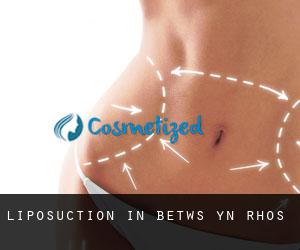 Liposuction in Betws-yn-Rhôs