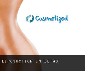 Liposuction in Betws