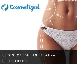 Liposuction in Blaenau-Ffestiniog