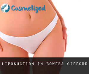 Liposuction in Bowers Gifford