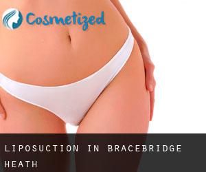 Liposuction in Bracebridge Heath