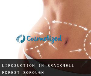Liposuction in Bracknell Forest (Borough)
