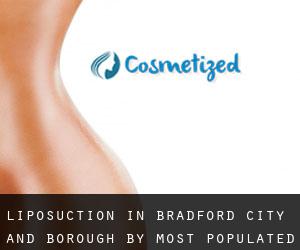 Liposuction in Bradford (City and Borough) by most populated area - page 1