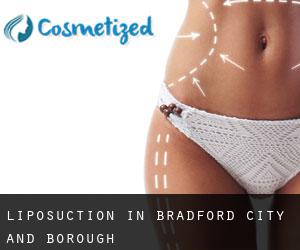 Liposuction in Bradford (City and Borough)