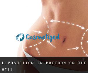 Liposuction in Breedon on the Hill