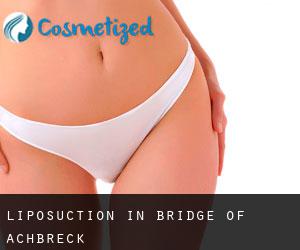 Liposuction in Bridge of Achbreck