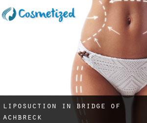 Liposuction in Bridge of Achbreck Liposuction in Bridge of Achbreck