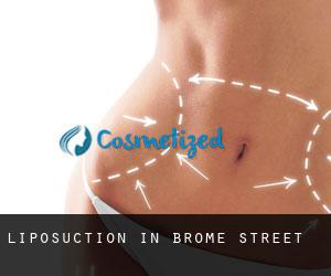 Liposuction in Brome Street