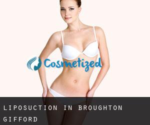 Liposuction in Broughton Gifford