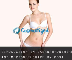 Liposuction in Caernarfonshire and Merionethshire by most populated area - page 3