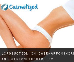 Liposuction in Caernarfonshire and Merionethshire by municipality - page 2