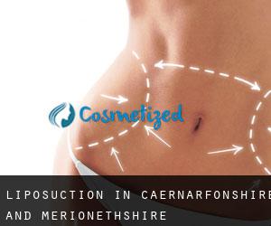 Liposuction in Caernarfonshire and Merionethshire