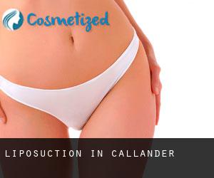 Liposuction in Callander