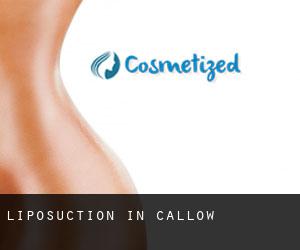 Liposuction in Callow