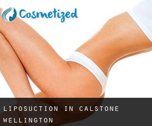 Liposuction in Calstone Wellington